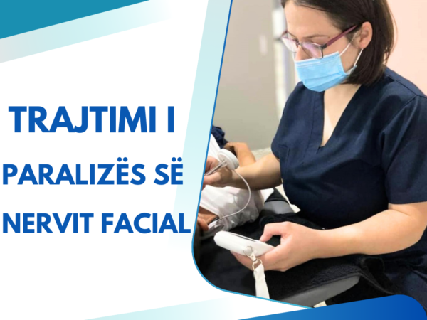 Çfarë është paraliza e nervit facial?