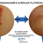 Hemangiomë e shëruar plotësisht