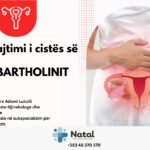 Trajtimi i cistës së Bartholinit